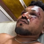 एयर इंडिया विमान दुर्घटना अहमदाबाद: सीट 11ए पर एक जीवित बचा व्यक्ति मिला – जीवित बचे व्यक्ति की हालत क्या है?