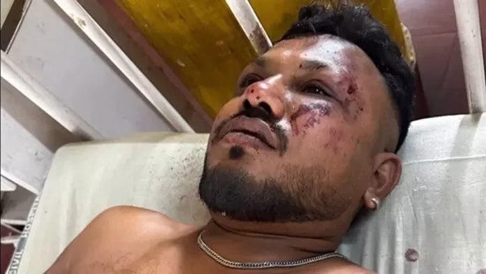 एयर इंडिया विमान दुर्घटना अहमदाबाद: सीट 11ए पर एक जीवित बचा व्यक्ति मिला - जीवित बचे व्यक्ति की हालत क्या है?