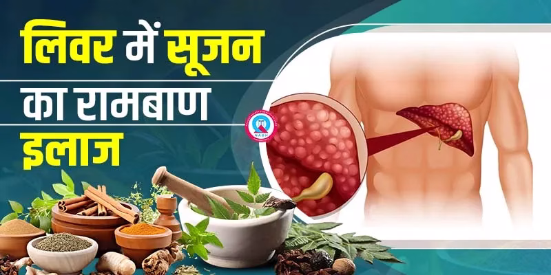 प्राकृतिक उपचार हिंदी